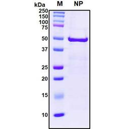 Recombinant SARS-CoV-2 Nucleocapsid Protein - RayBiotech Inc. - Life Sciences