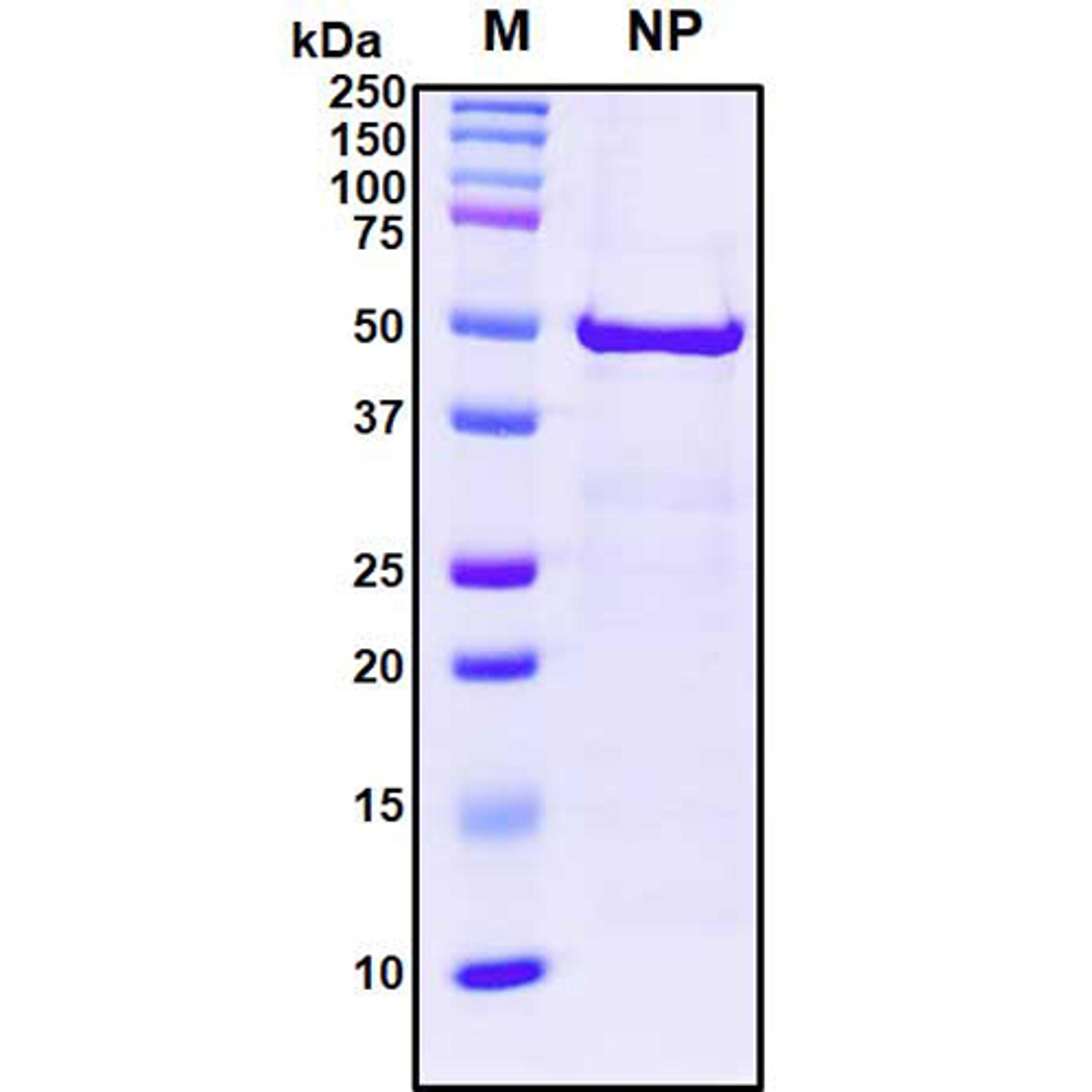 Recombinant SARS-CoV-2 Nucleocapsid Protein - RayBiotech Inc. - Life Sciences
