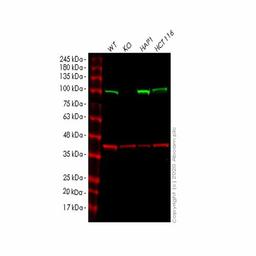 Human KDM1B (LSD2 / AOF1) knockout HeLa cell line - Abcam plc - Life Sciences