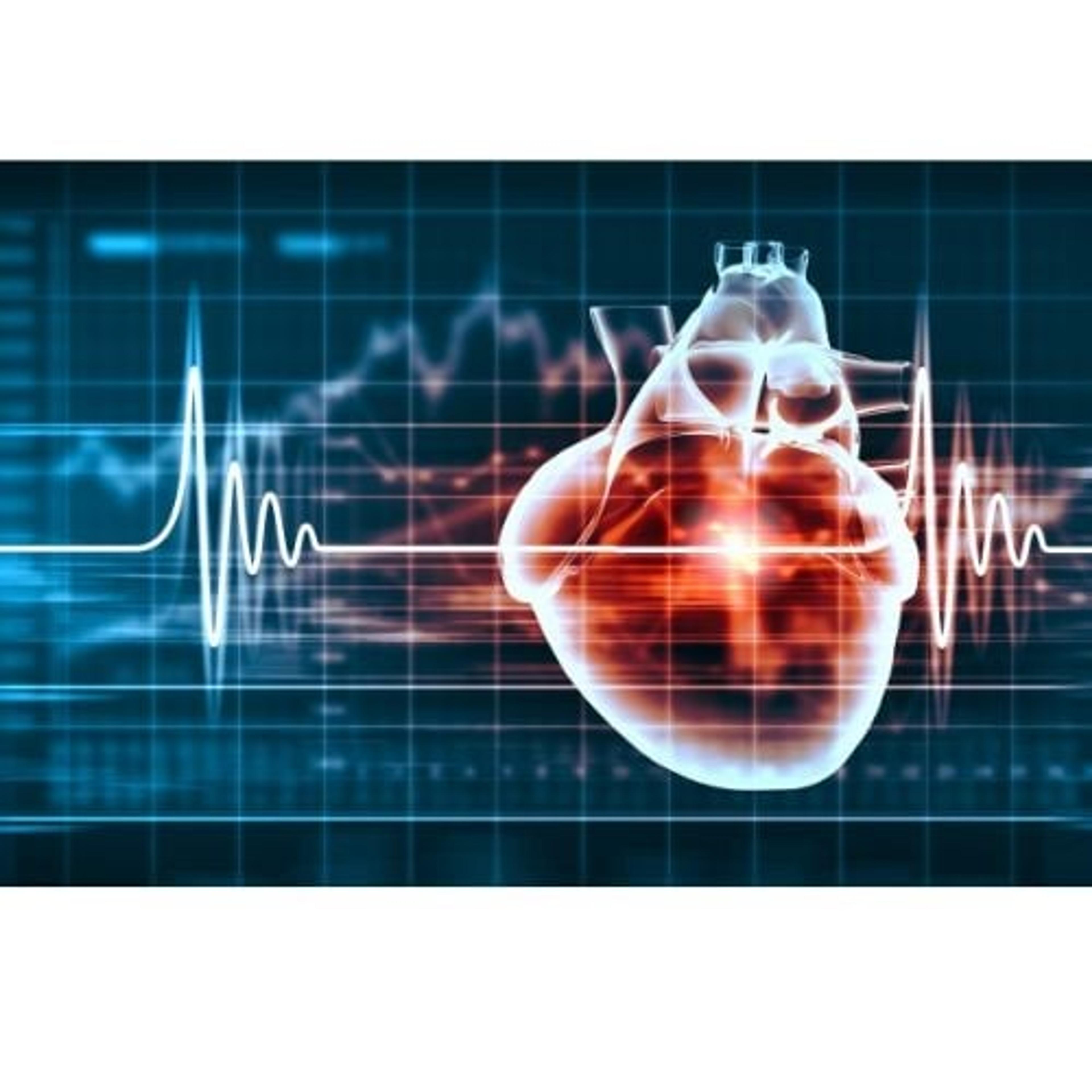 Rodent Cardiovascular Telemetry - Inotiv - Drug discovery > Pre-Clinical Development