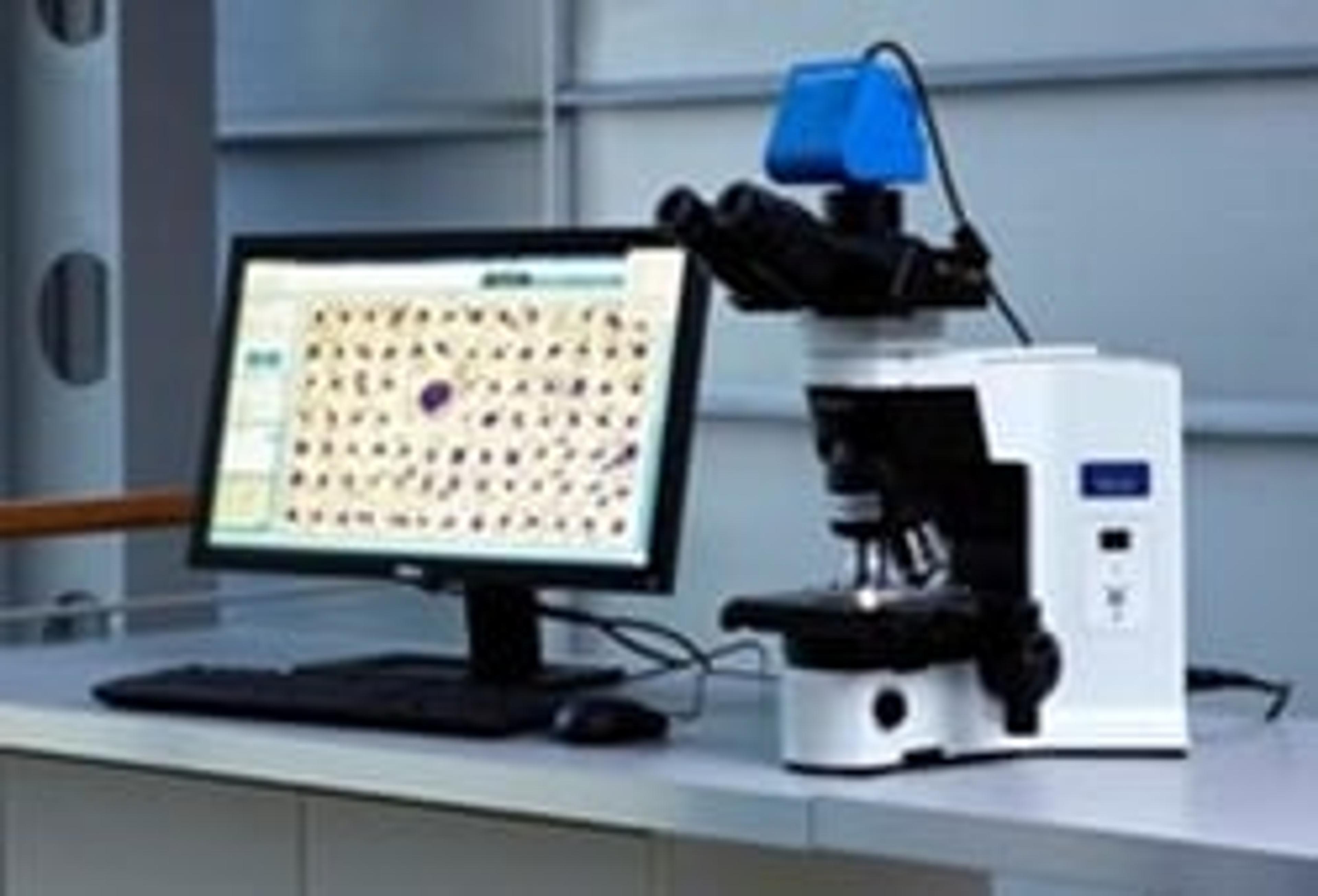 Cellavision Image Capture System - CellaVision AB - Clinical Diagnostics