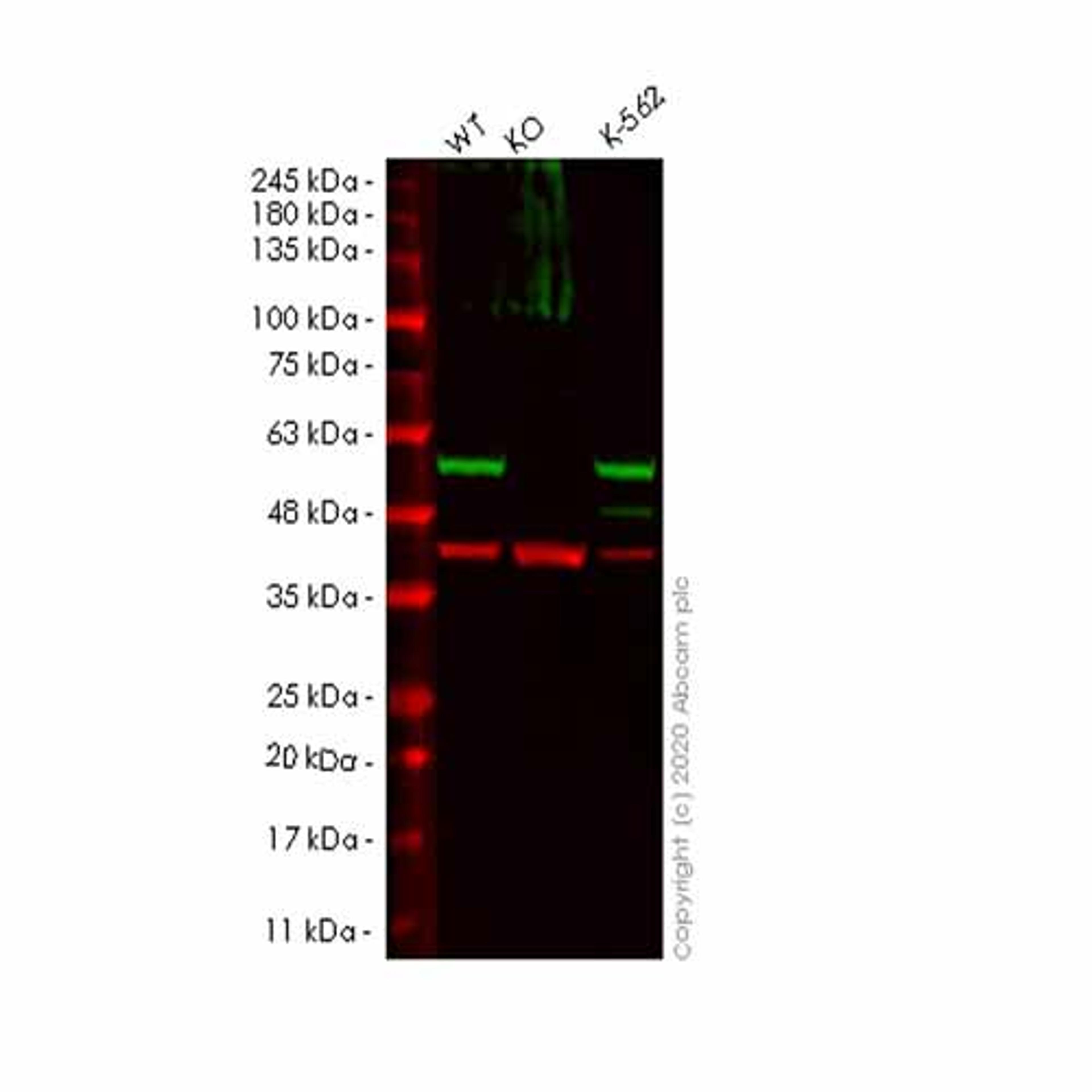 Human PRKAR2A (PKA R2/PKR2) knockout HeLa cell line - Abcam plc - Life Sciences