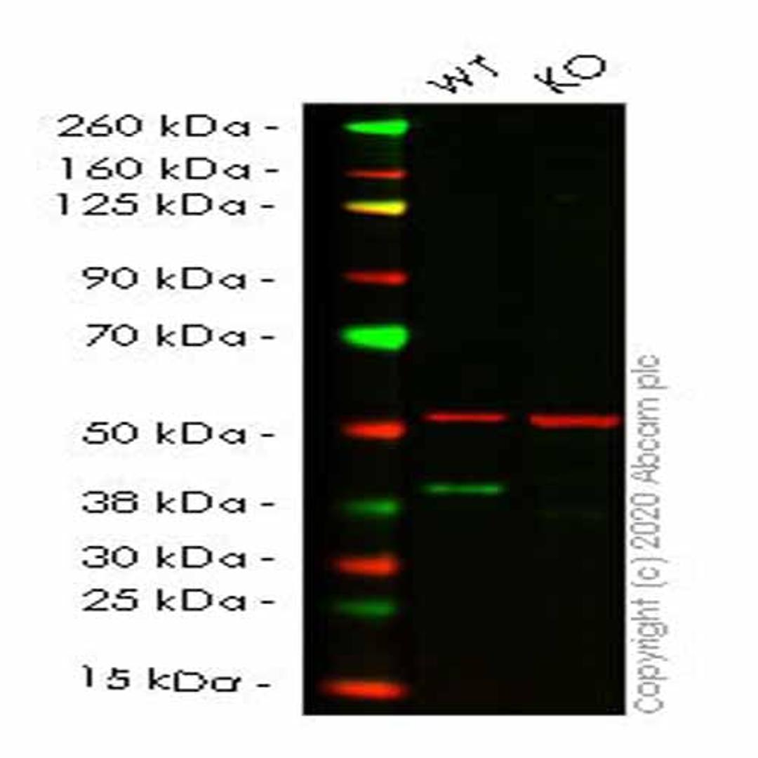 Human RRM2B (p53R2) knockout HCT116 cell line - Abcam plc - Life Sciences