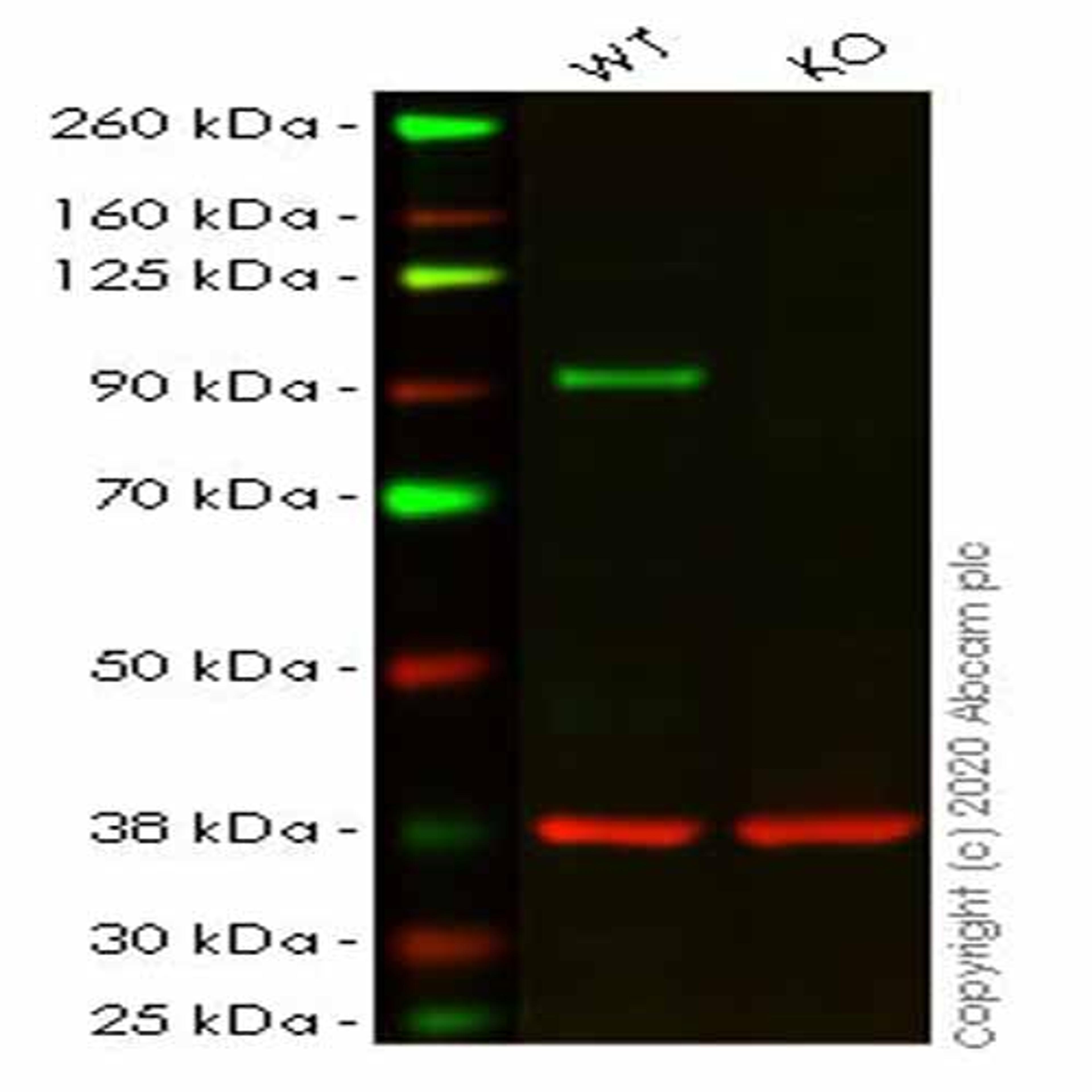 Human STAT5B knockout HeLa cell line - Abcam plc - Life Sciences