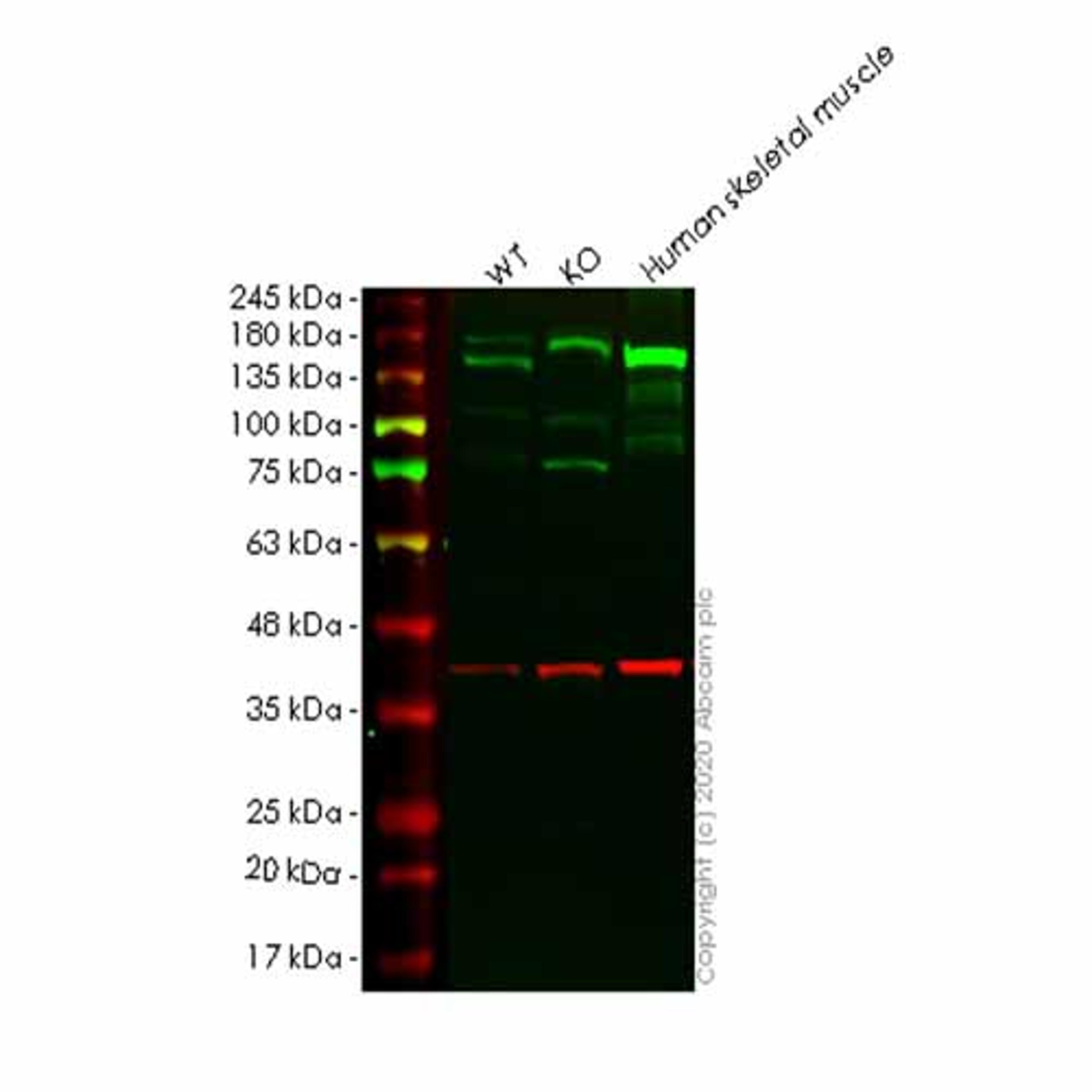 Human COL6A1 knockout HEK293T cell line - Abcam plc - Life Sciences