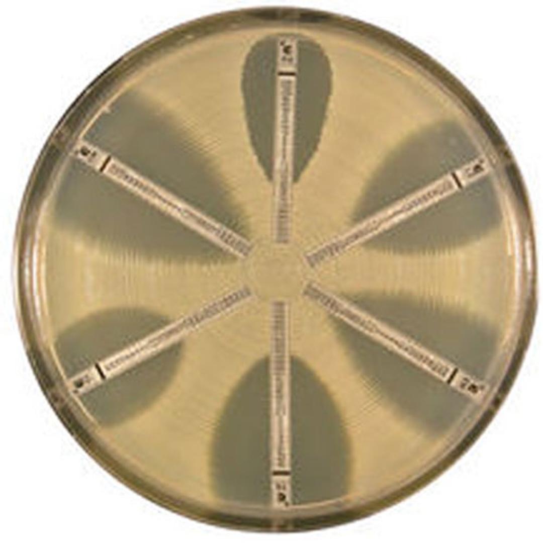 ETEST® - bioMérieux USA - Life Sciences