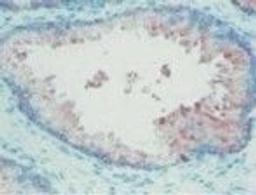 AEC Tablets - Fizzing - Buffer-containing, pH 5.1 - null - Life Sciences