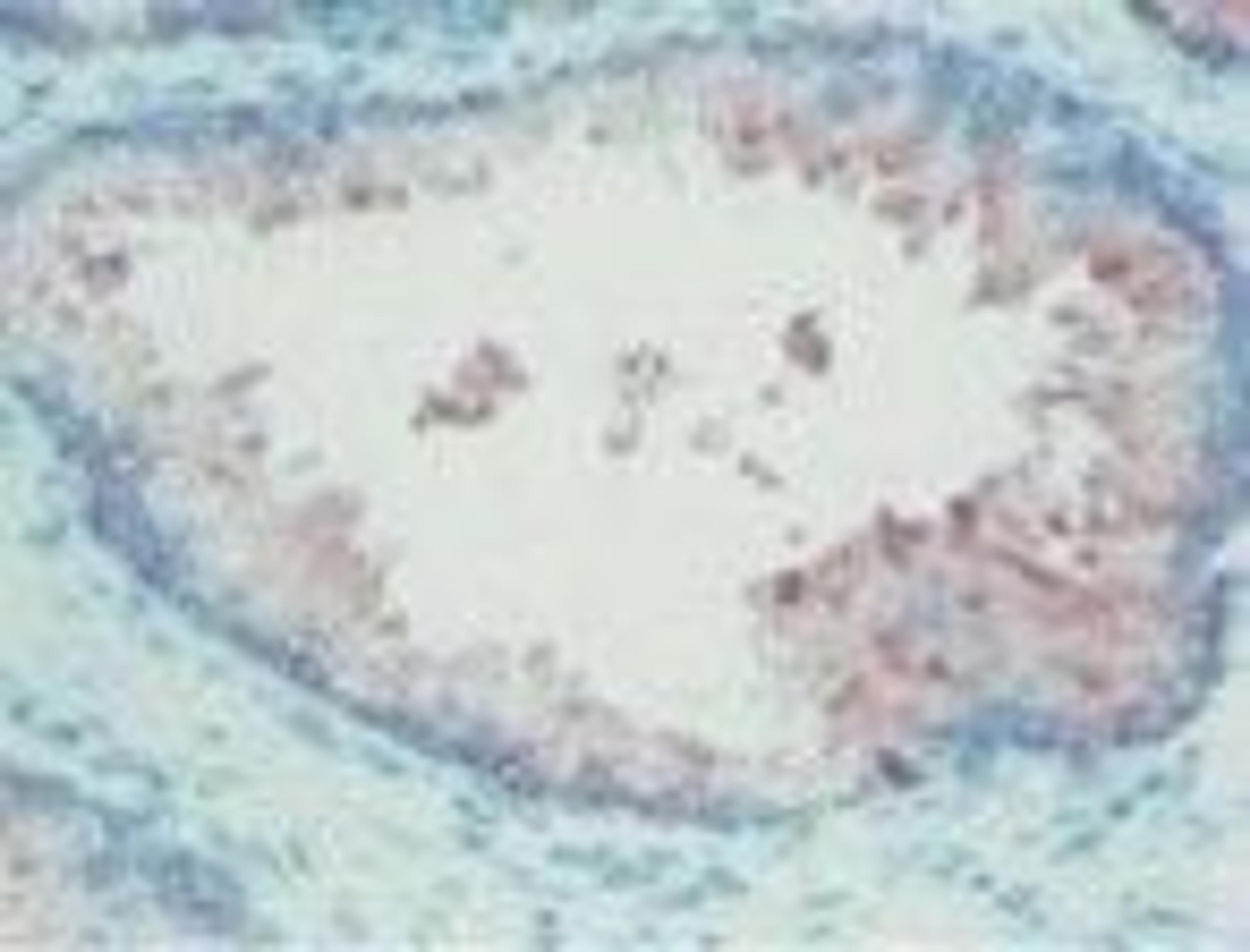 AEC Tablets - Fizzing - Buffer-containing, pH 5.1 - null - Life Sciences