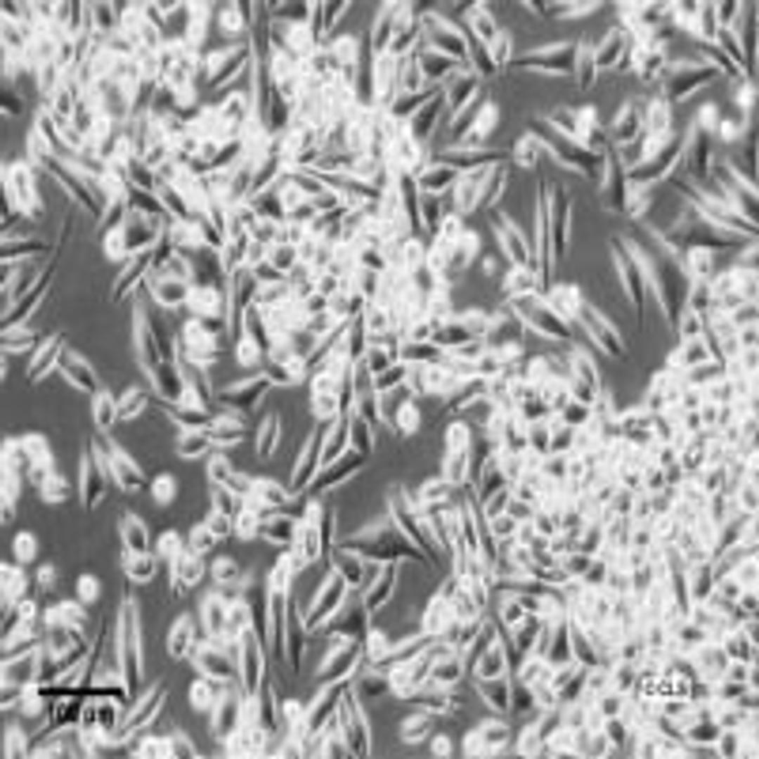 MIA PaCa-2 - Cell Lines Service GmbH - Life Sciences