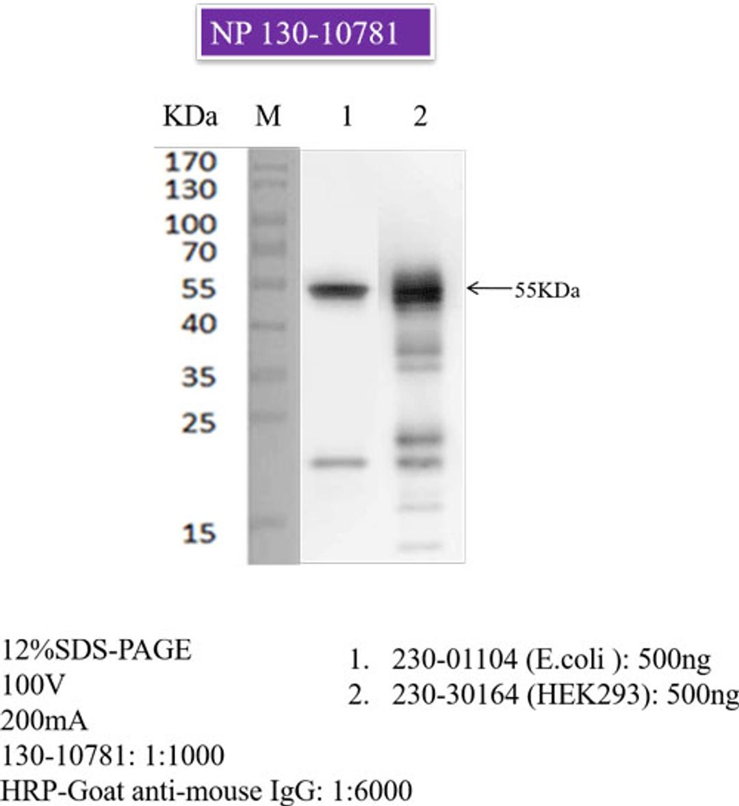 Mouse anti-SARS-COV-2 N-Protein (1G1-F2) - RayBiotech Inc. - Life Sciences