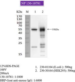 Mouse anti-SARS-COV-2 N-Protein (1G1-F2) - RayBiotech Inc. - Life Sciences