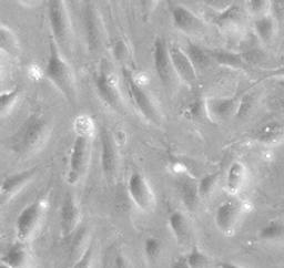 HUVEC - Cell Lines Service GmbH - Life Sciences