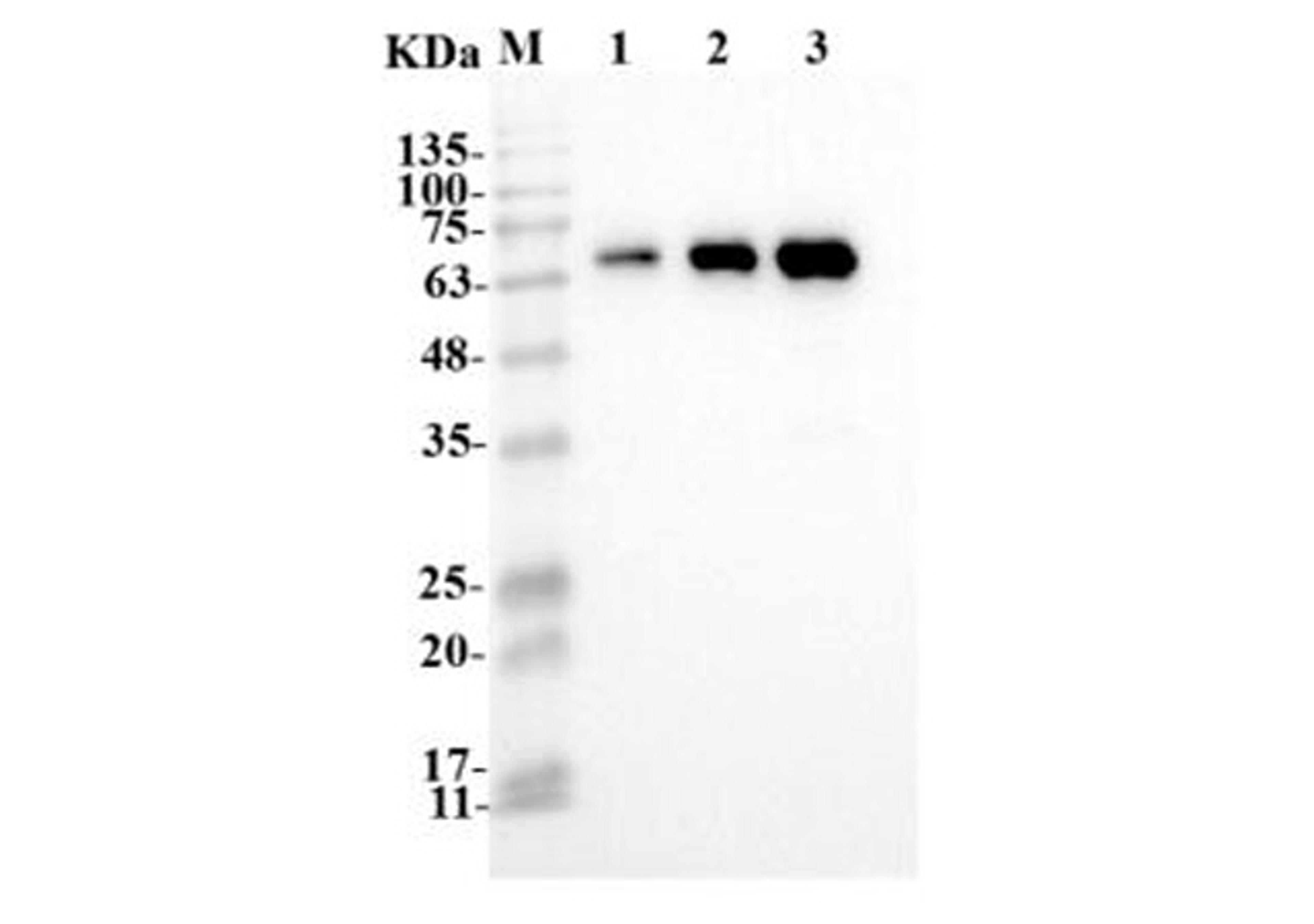 Anti-human IL23A Recombinant Antibody (TAB-620LC)