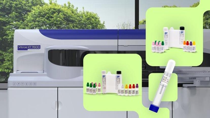 VITROS MPA fCAL/fPELA turbo assays