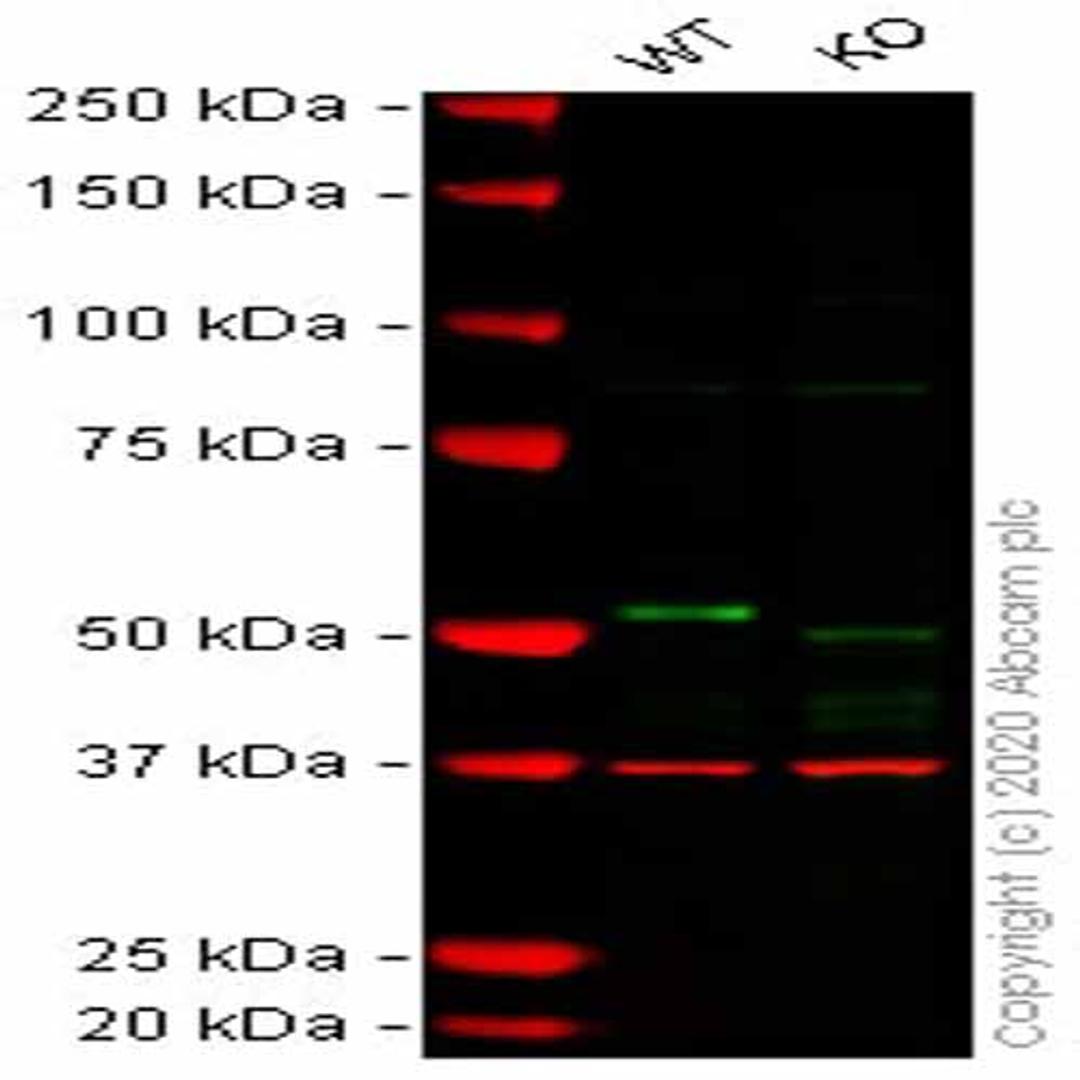 Human DAPK3 (ZIP Kinase) knockout HEK293T cell line - Abcam plc - Life Sciences