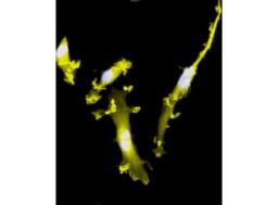 CRISPR-Ready ioMicroglia - bit.bio - Life Sciences