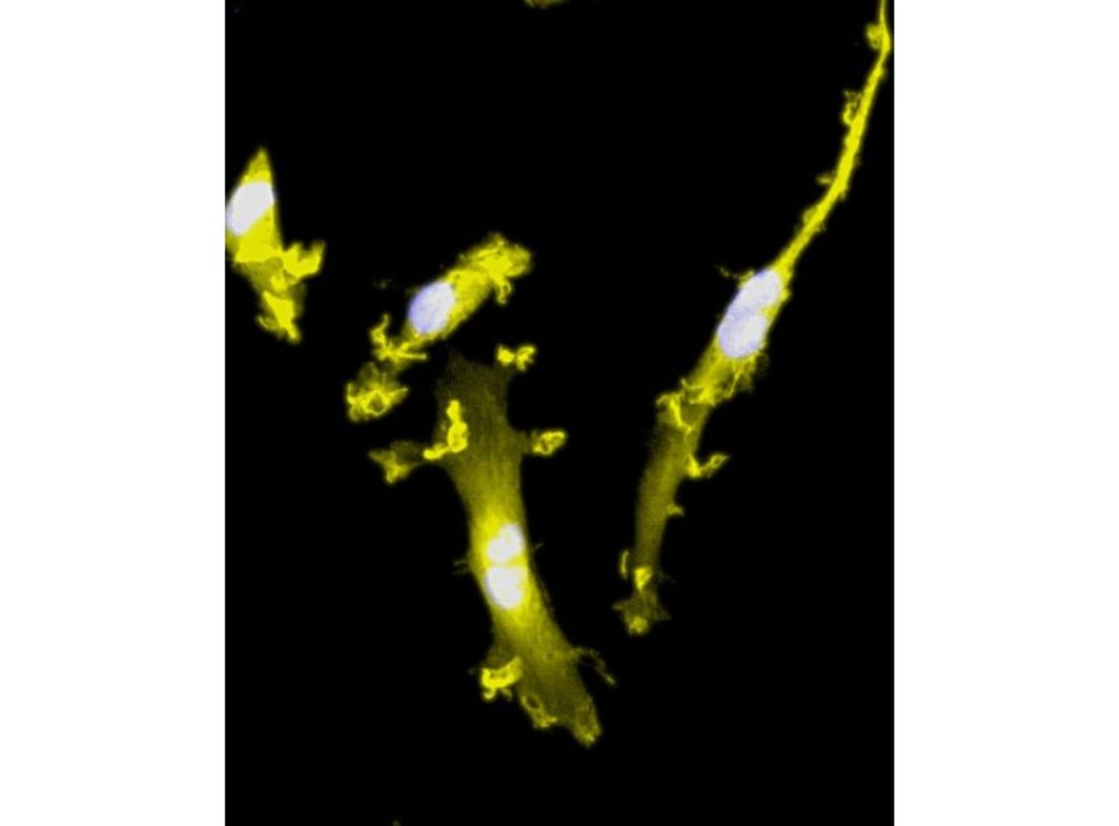 CRISPR-Ready ioMicroglia - bit.bio - Life Sciences