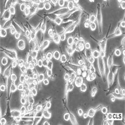 SK-MEL-5 - Cell Lines Service GmbH - Life Sciences