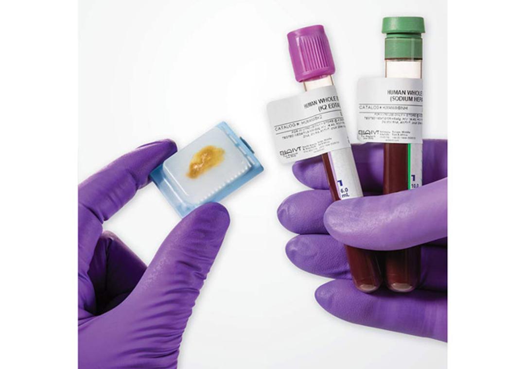 Clinically-Collected Specimens - BioIVT - Life Sciences