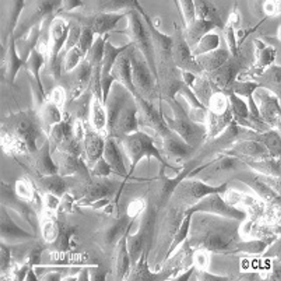 MG-63 - Cell Lines Service GmbH - Life Sciences