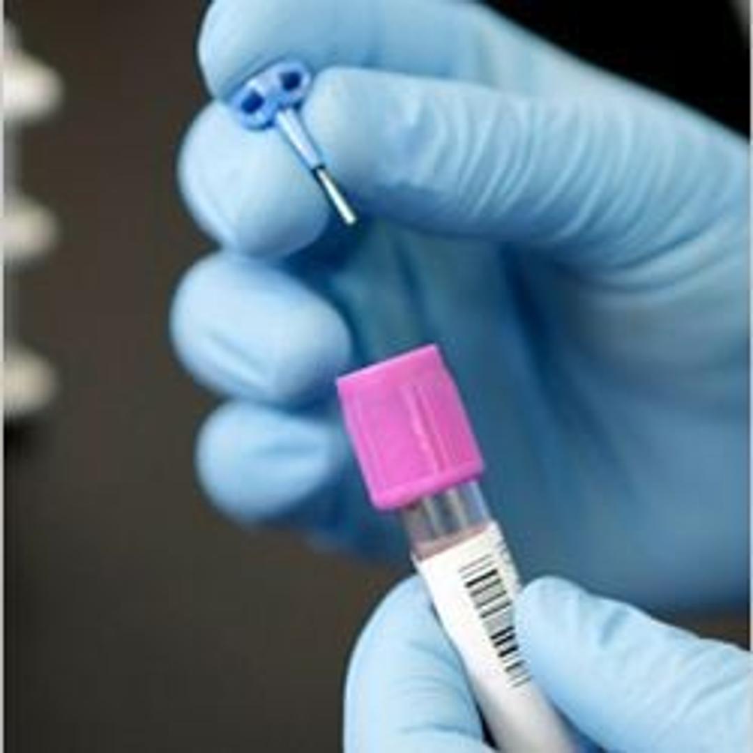 SmearSafe Blood Dispenser - Typenex Medical LLC - Clinical Diagnostics