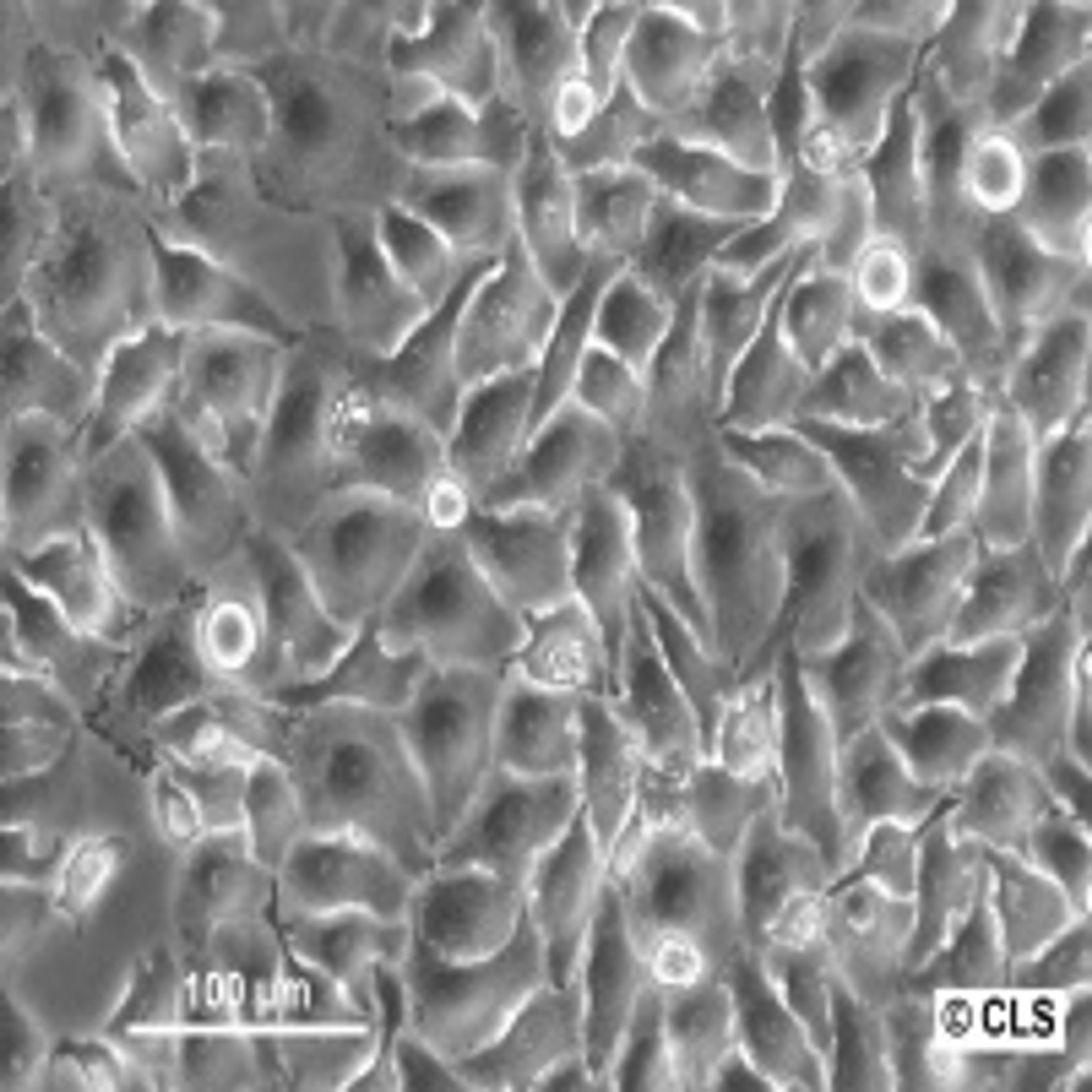 RT-112 - Cell Lines Service GmbH - Life Sciences