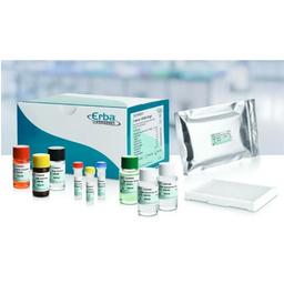 ErbaLisa COVID-19 IgG and IgM Antibody ELISA Kits - Erba Mannheim - Life Sciences