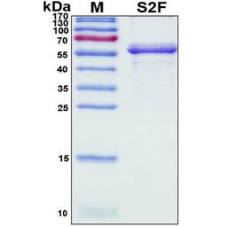 Recombinant SARS-CoV-2 Spike Protein, S2 Subunit - RayBiotech Inc. - Life Sciences