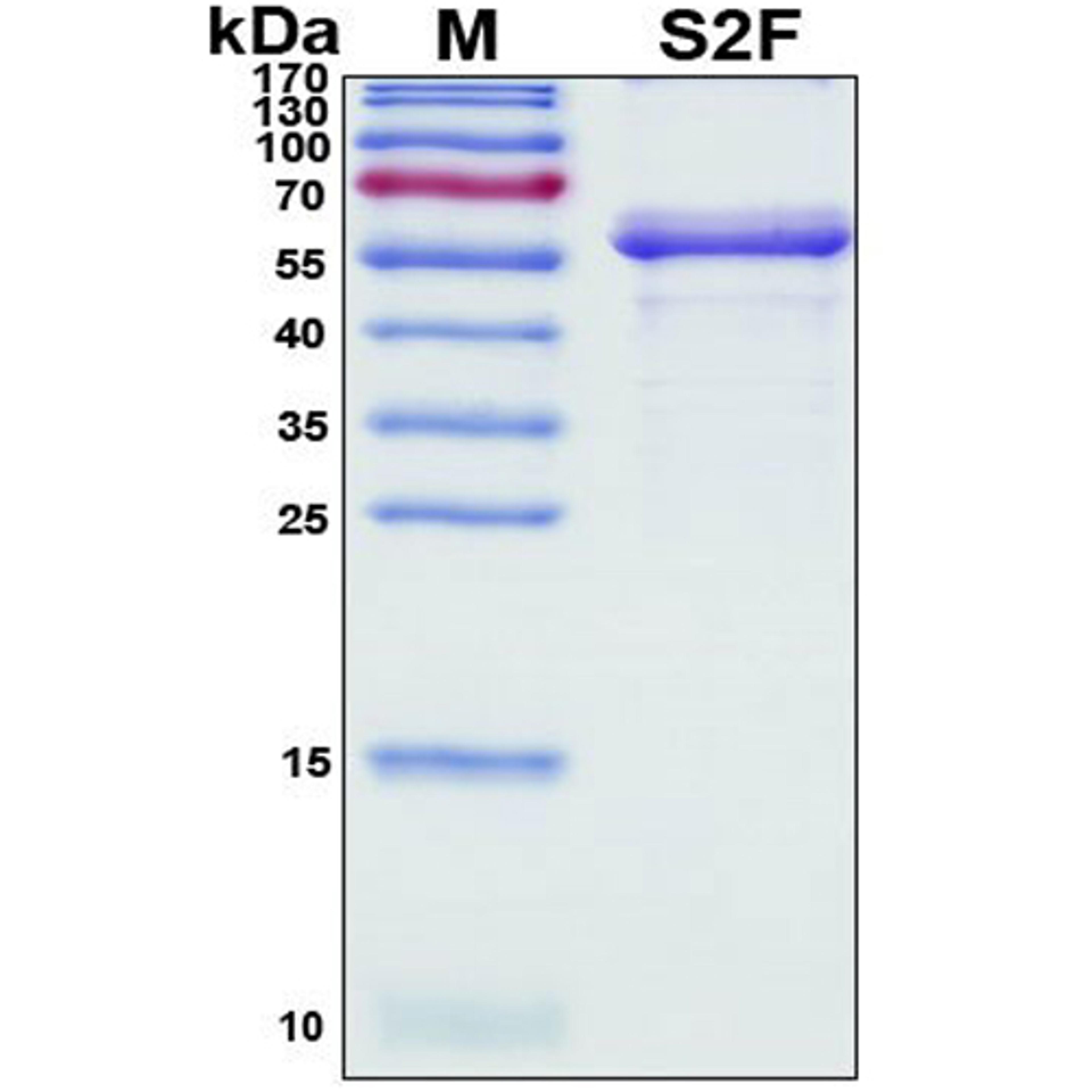 Recombinant SARS-CoV-2 Spike Protein, S2 Subunit - RayBiotech Inc. - Life Sciences
