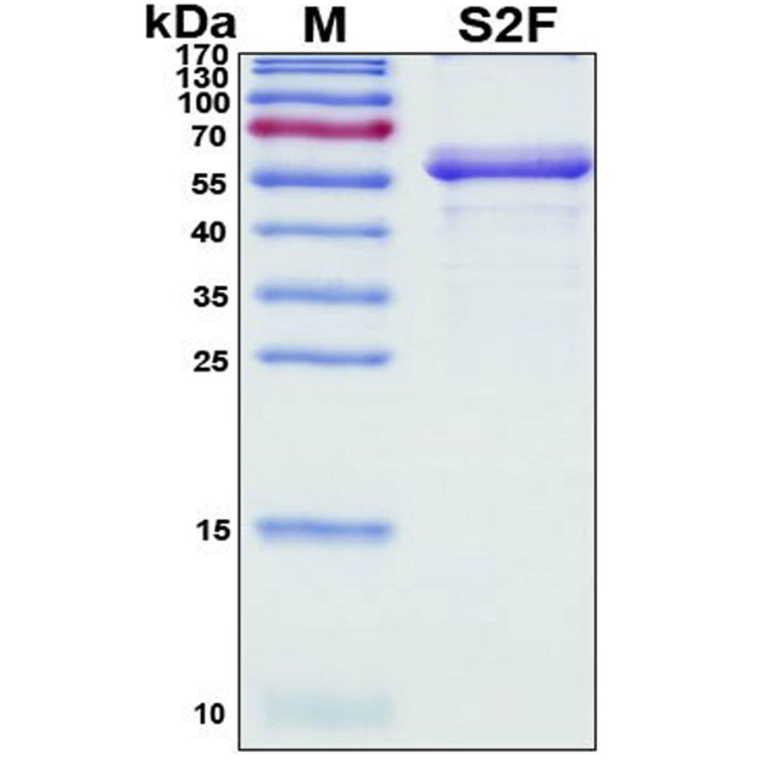 Recombinant SARS-CoV-2 Spike Protein, S2 Subunit - RayBiotech Inc. - Life Sciences