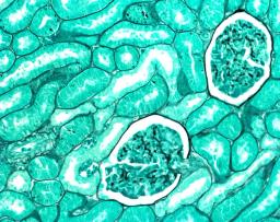Methenamine silver plating kit acc. to Gomorri - Merck KGaA, Darmstadt, Germany - Clinical Diagnostics