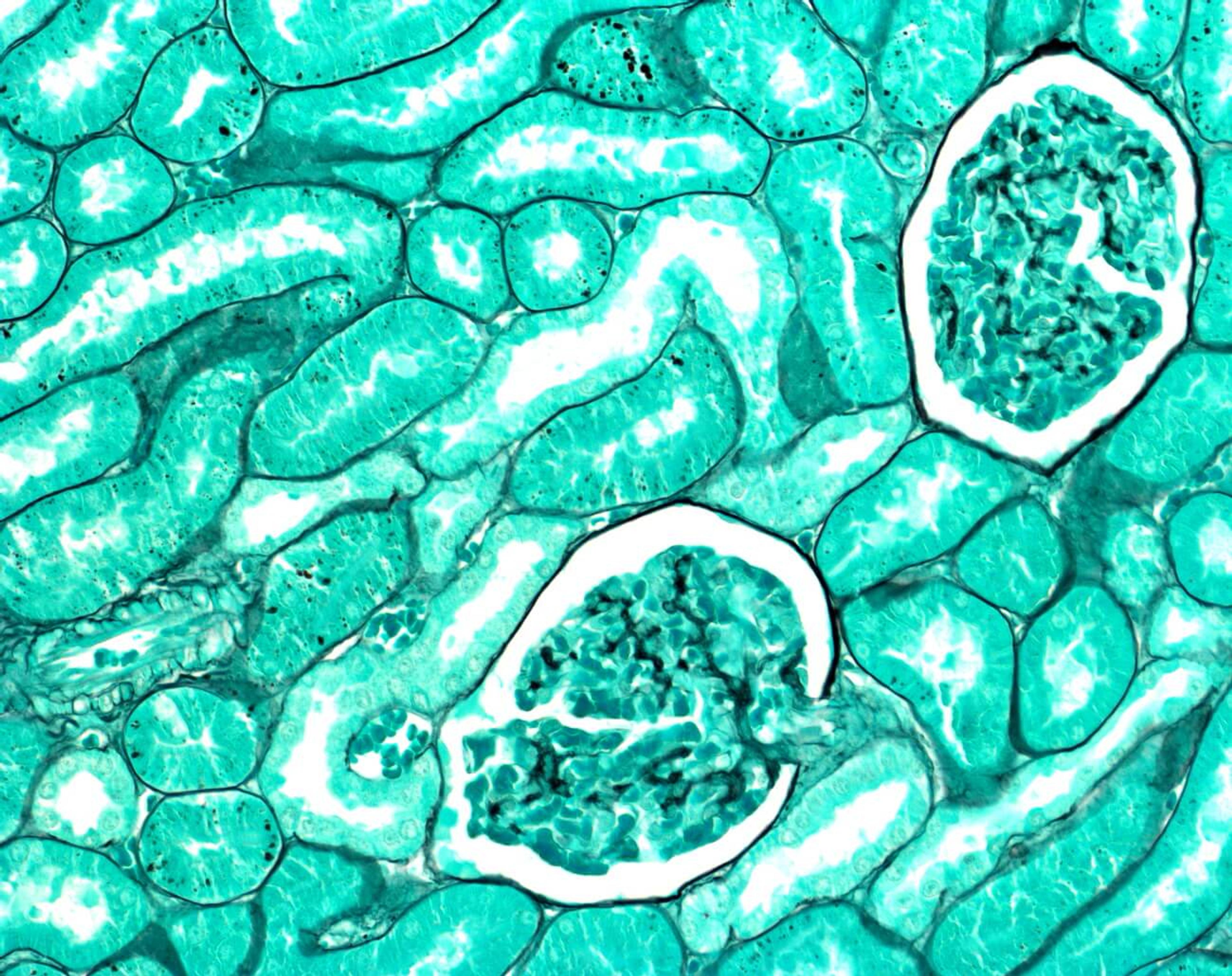 Methenamine silver plating kit acc. to Gomorri - Merck KGaA, Darmstadt, Germany - Clinical Diagnostics