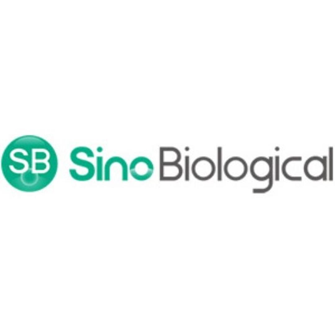 Mammalian Transient Protein Expression Service - Sino Biological - Life Sciences