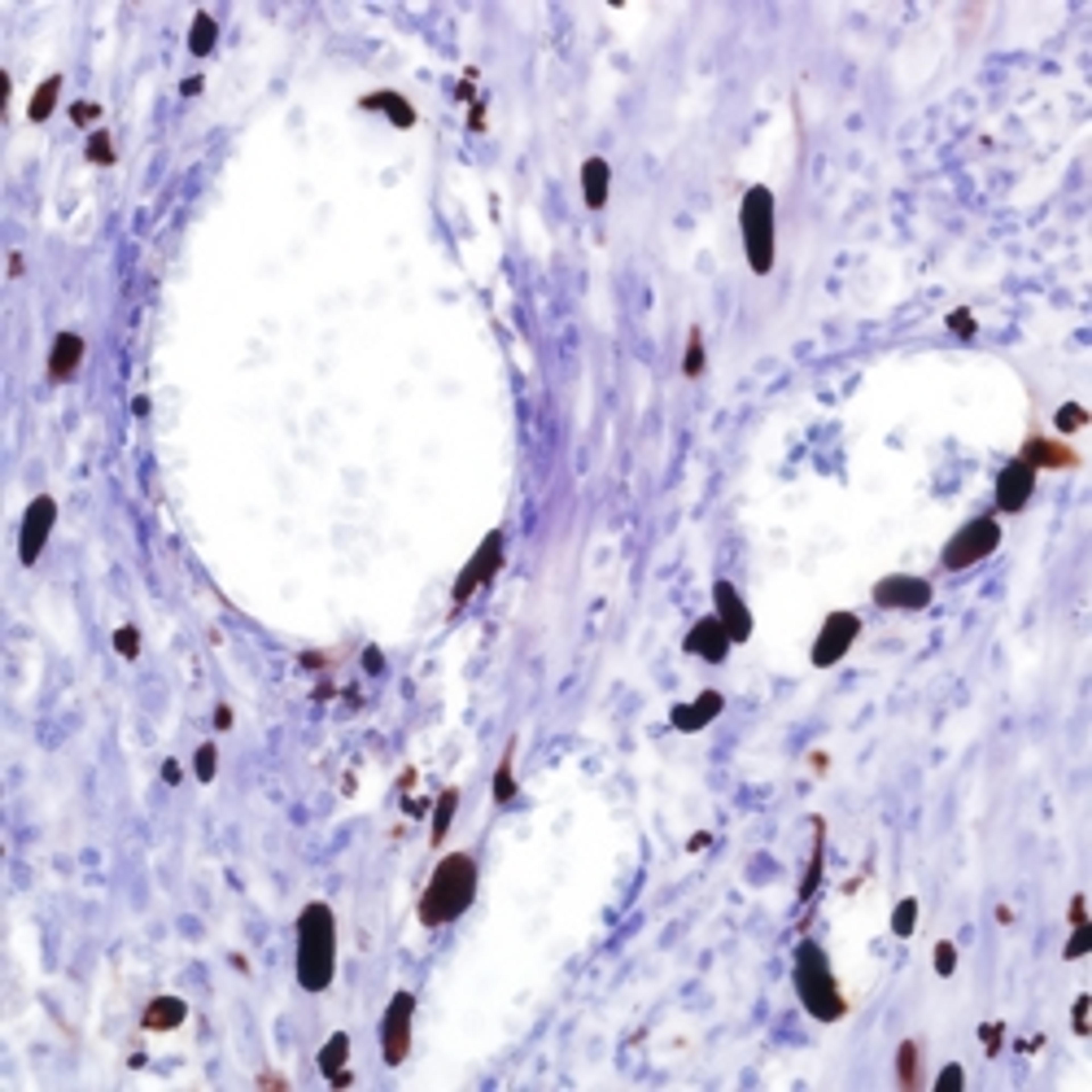 CMV (8B1.2, 1G5.2 & 2D4.2) - Merck - Life Sciences