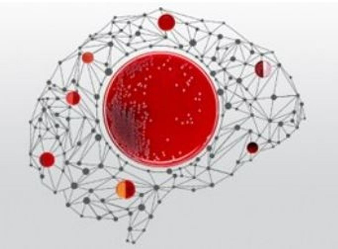 SmartPlate format for Thermo Scientific™ Remel™ and Oxoid™ prepared culture media - Thermo Fisher Scientific - Life Sciences