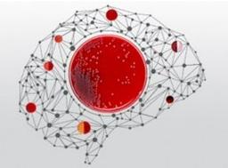 SmartPlate format for Thermo Scientific™ Remel™ and Oxoid™ prepared culture media - Thermo Fisher Scientific - Life Sciences