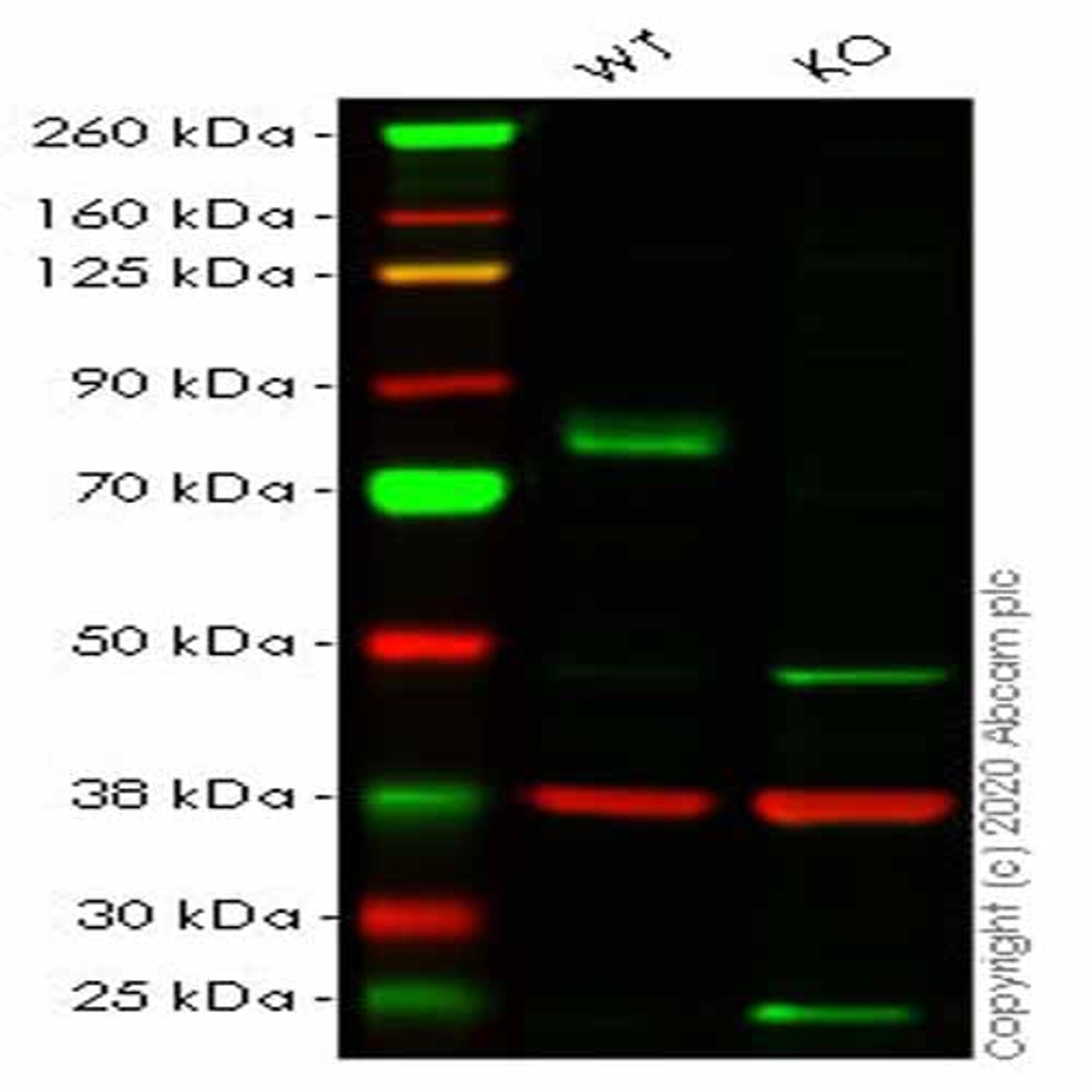 Human MAP3K2 (MEKK2) knockout HeLa cell line - Abcam plc - Life Sciences