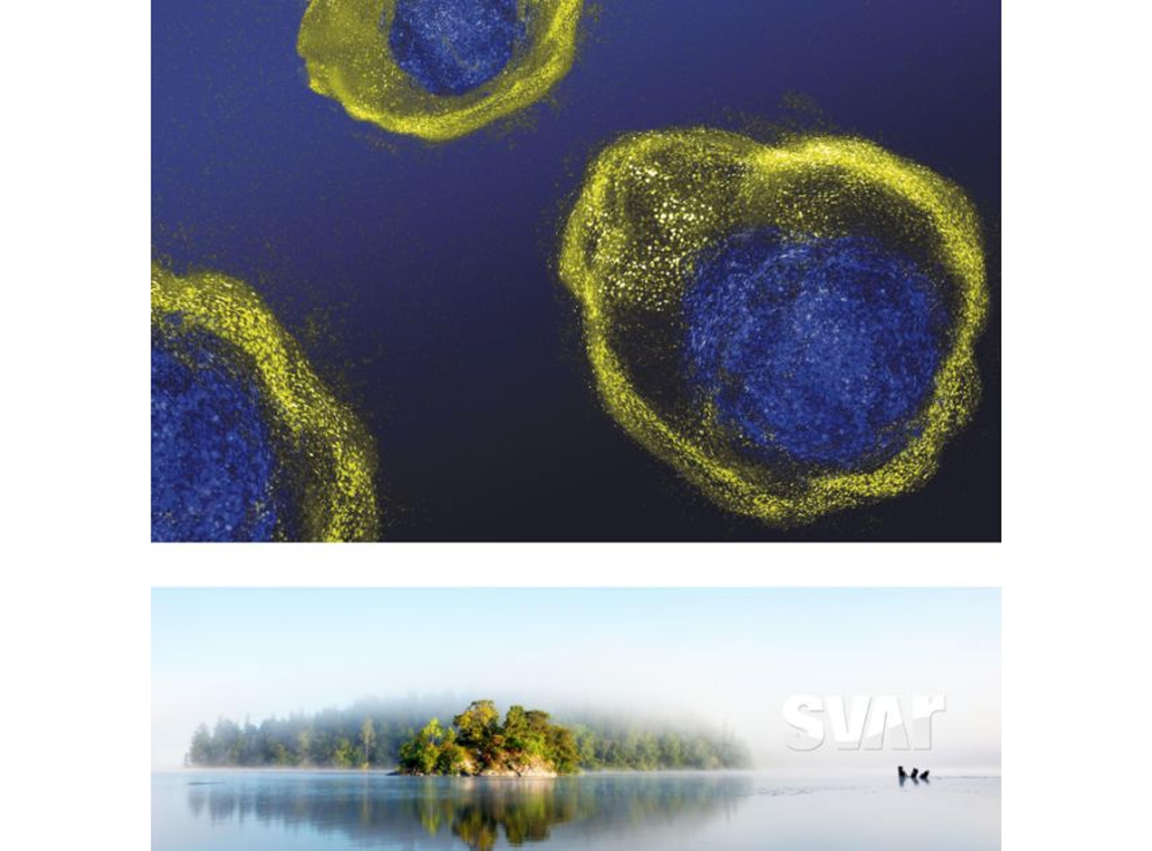 iLite® Custom Development & Cell-based Services - Svar Life Science AB - Life Sciences