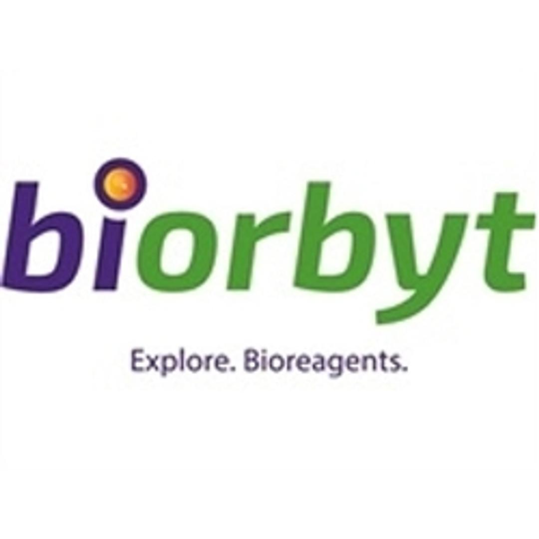 TL1A antibody - Biorbyt - Life Sciences