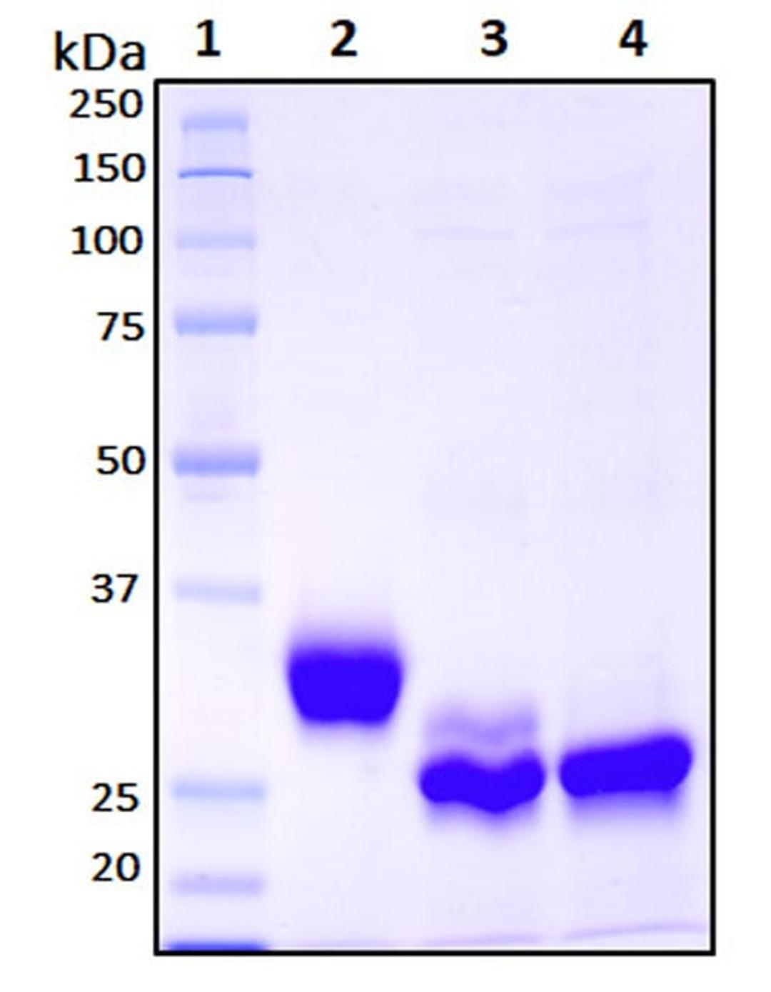 Recombinant SARS-CoV-2, S1 Subunit Protein (RBD) - RayBiotech Inc. - Life Sciences