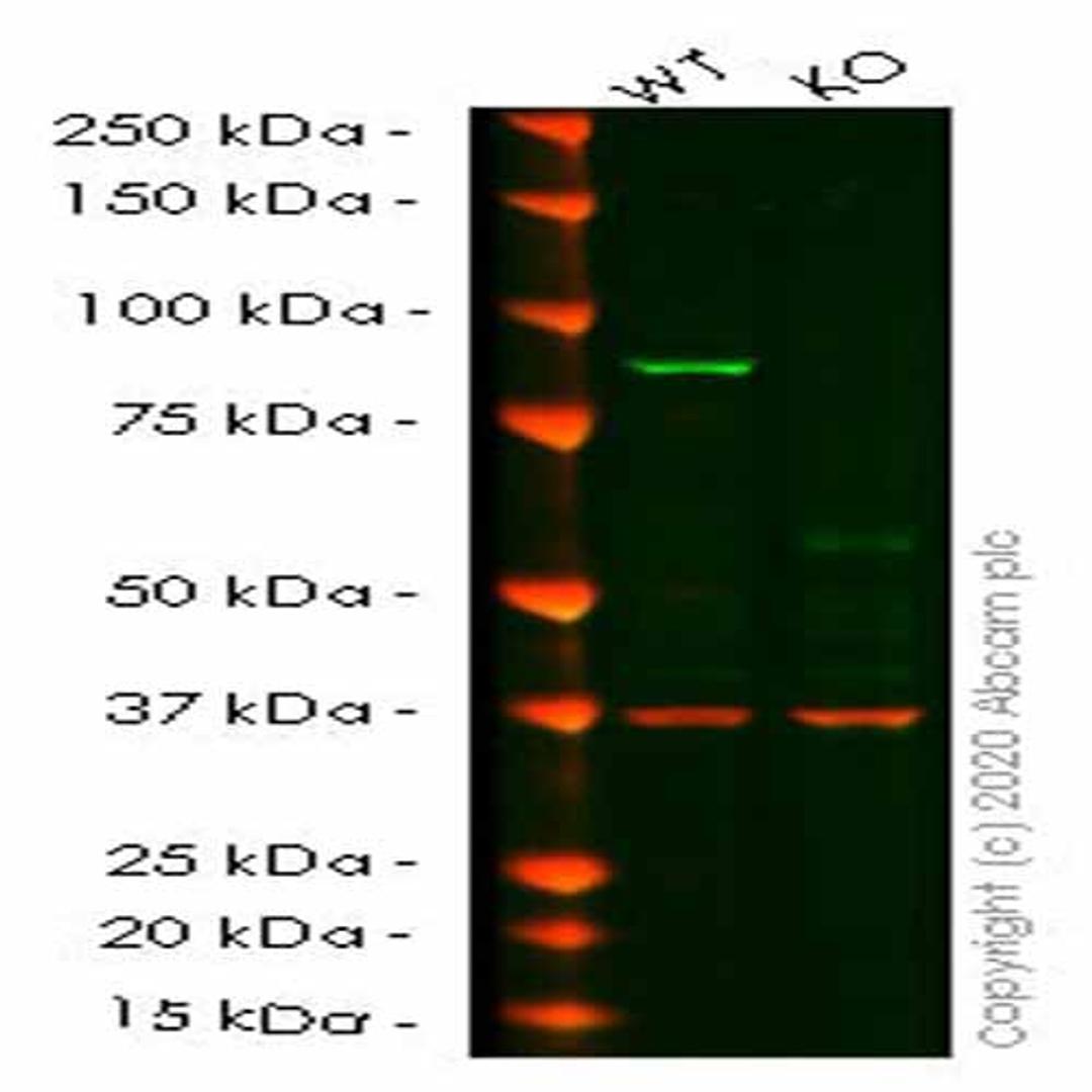Human IKBKB (IKK beta) knockout HeLa cell line - Abcam plc - Life Sciences