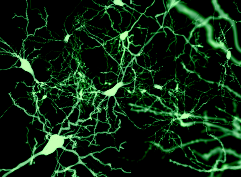 Neurons marked by Fluorescence