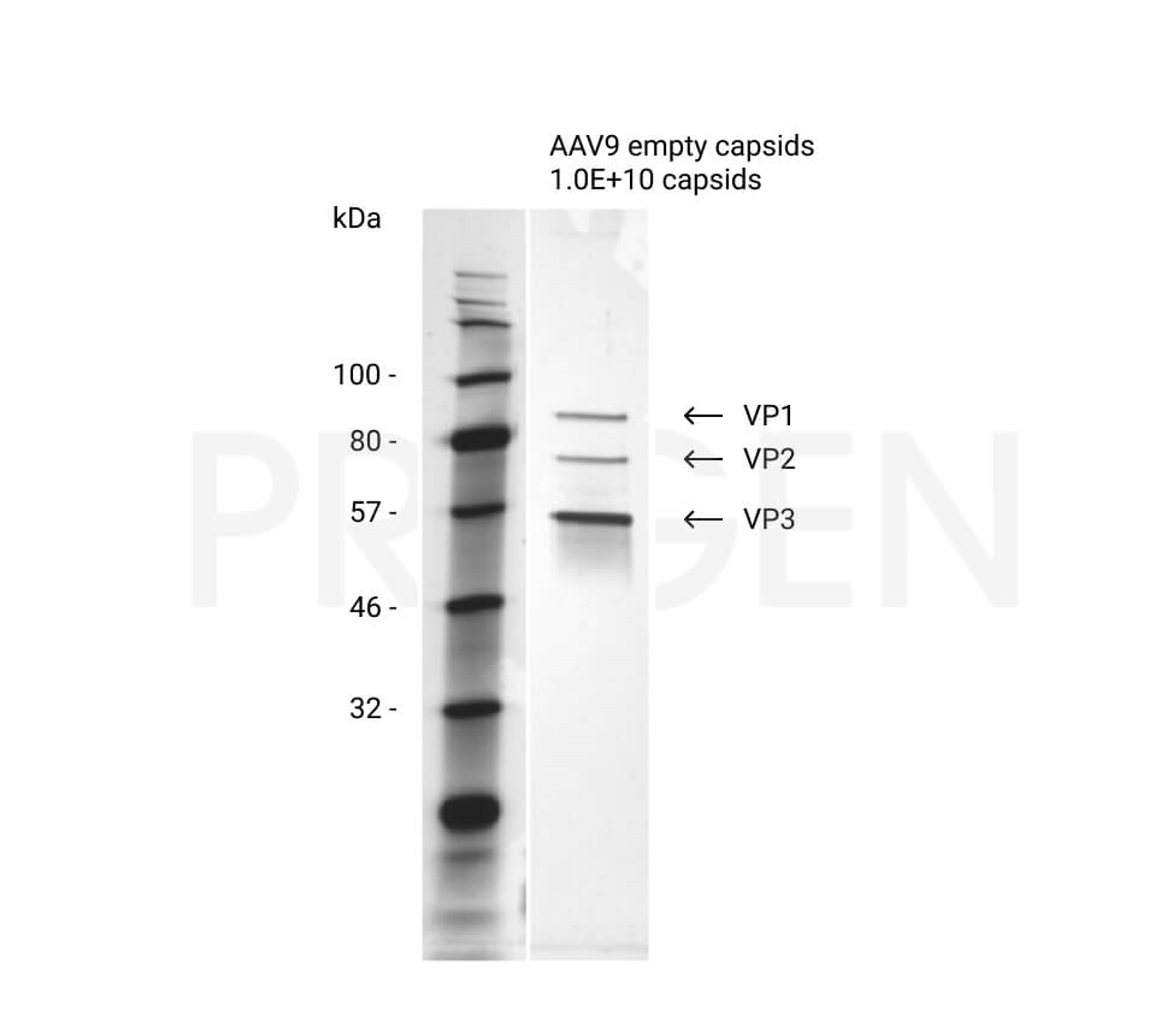 AAV9 empty capsids - PROGEN - Life Sciences