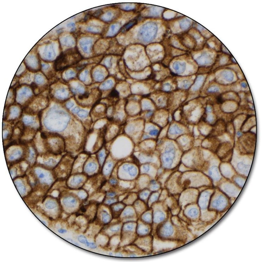 PD-L1 IHC 22C3 pharmDx for Autostainer Link 48 - Dako North America, Inc. - Clinical Diagnostics