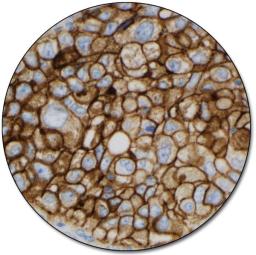 PD-L1 IHC 22C3 pharmDx for Autostainer Link 48 - Dako North America, Inc. - Clinical Diagnostics