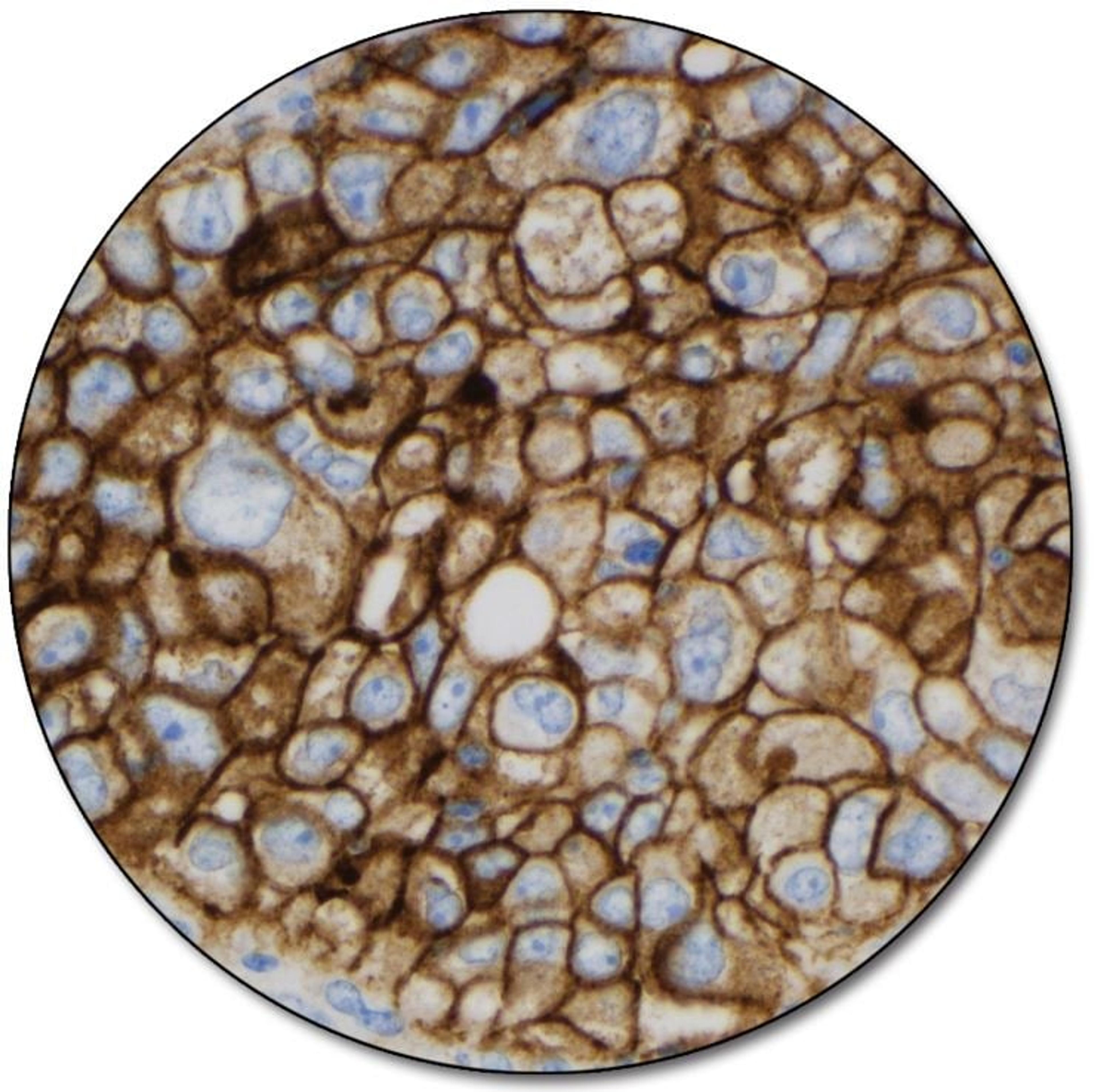 PD-L1 IHC 22C3 pharmDx for Autostainer Link 48 - Dako North America, Inc. - Clinical Diagnostics