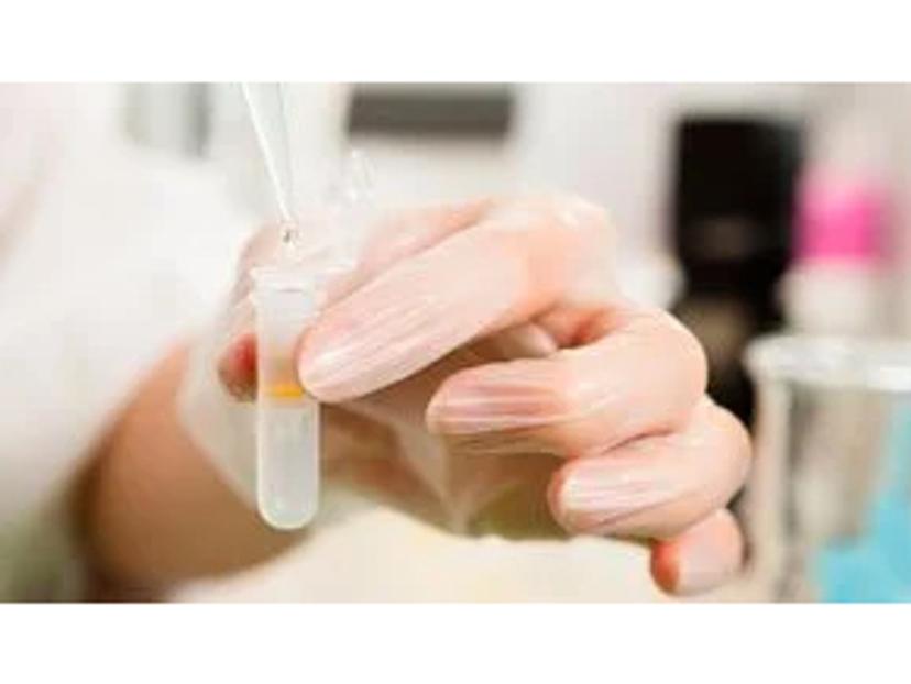 Automated, high-throughput plasmid DNA isolation from bacteria cells