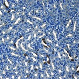 CD133 antibody - Biorbyt - Life Sciences