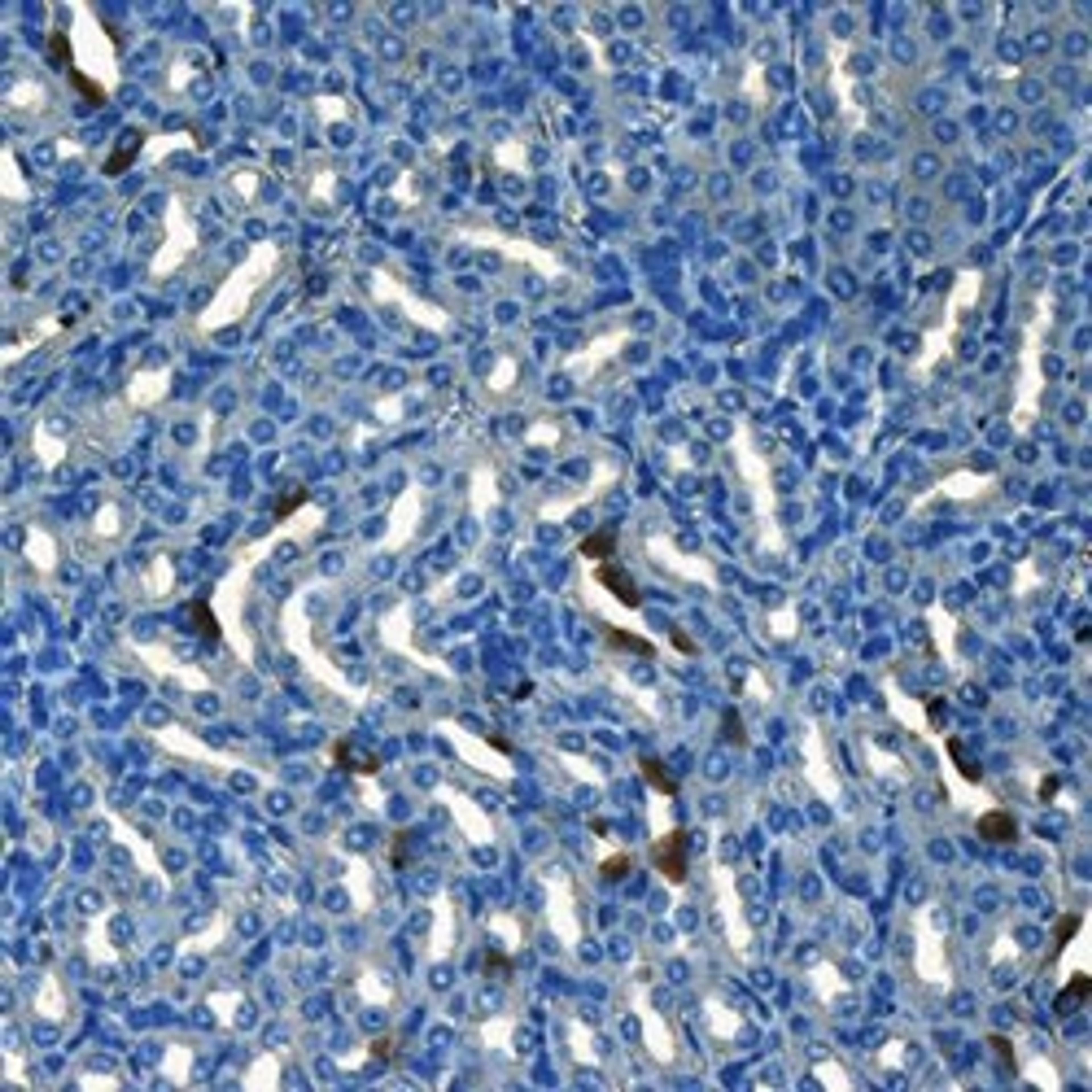 CD133 antibody - Biorbyt - Life Sciences