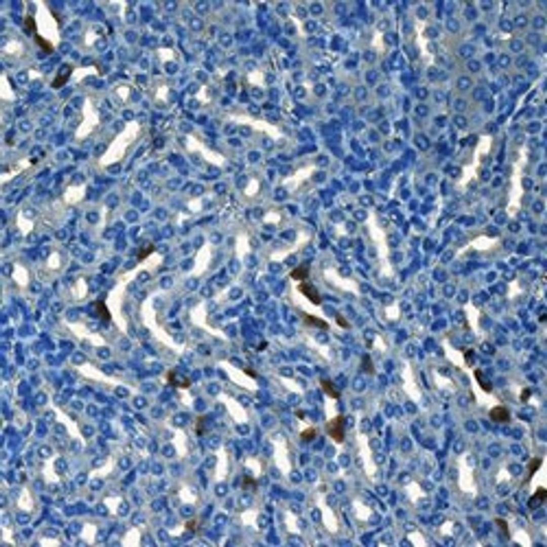 CD133 antibody - Biorbyt - Life Sciences